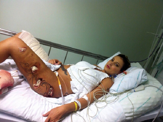 EXCLUSIVE: *WARNING: GRAPHIC CONTENT* Miss Butt Brazil in hospital for butt implant infection - weeks after 'rotting' legs almost killed her