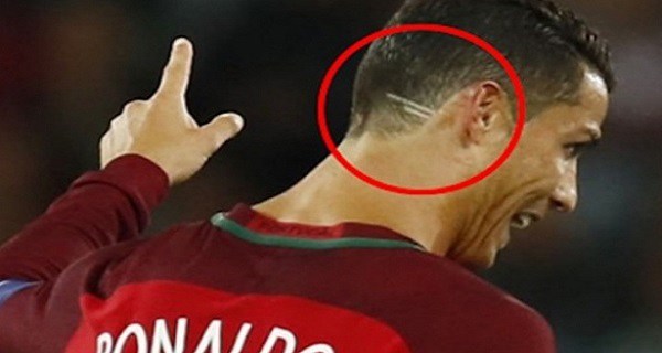 THE-WHOLE-WORLD-IS-IN-TEARS-They-Discovered-What-These-2-LINES-on-Ronaldo---s-Head-Mean